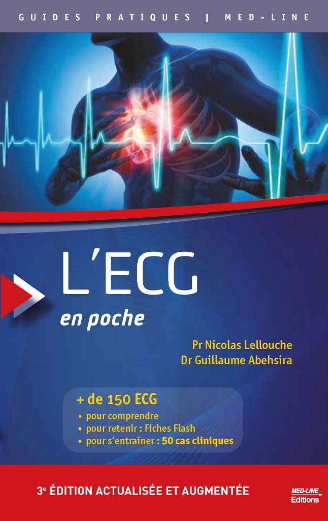 [Pdf] L’ECG en poche 3e édition actualisée et augmentée 2020 gratuit