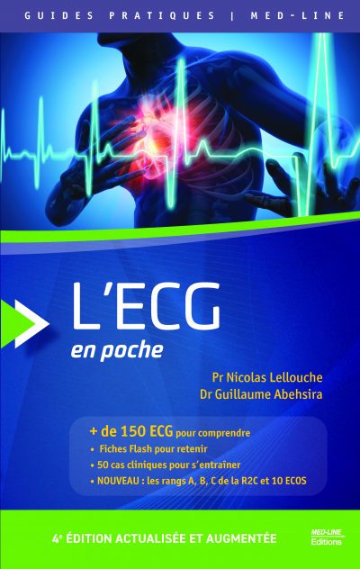 L’ECG en poche